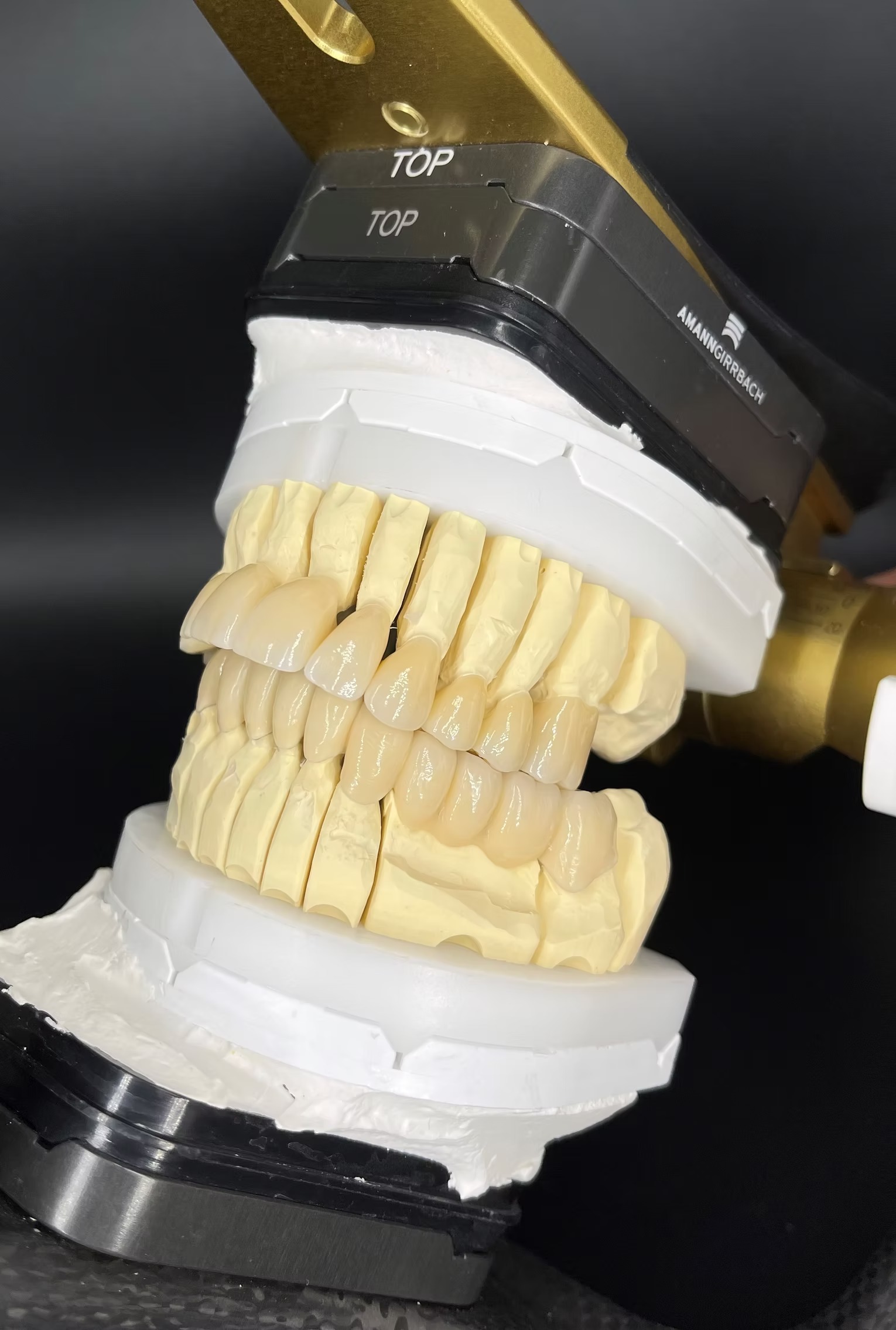 Ein Zahnersatzmodell mit elfenbeinfarbenen Zähnen in einem Gebisshalter.