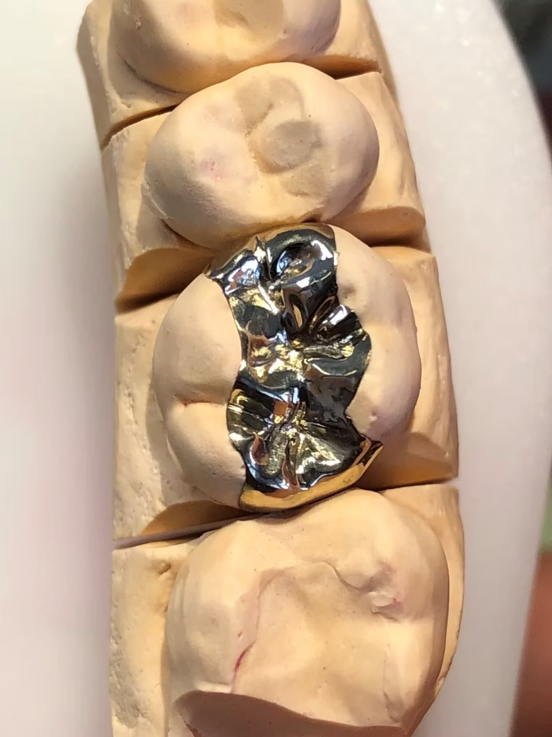 Nahaufnahme eines Zahnmodells mit einer metallischen Füllung.
