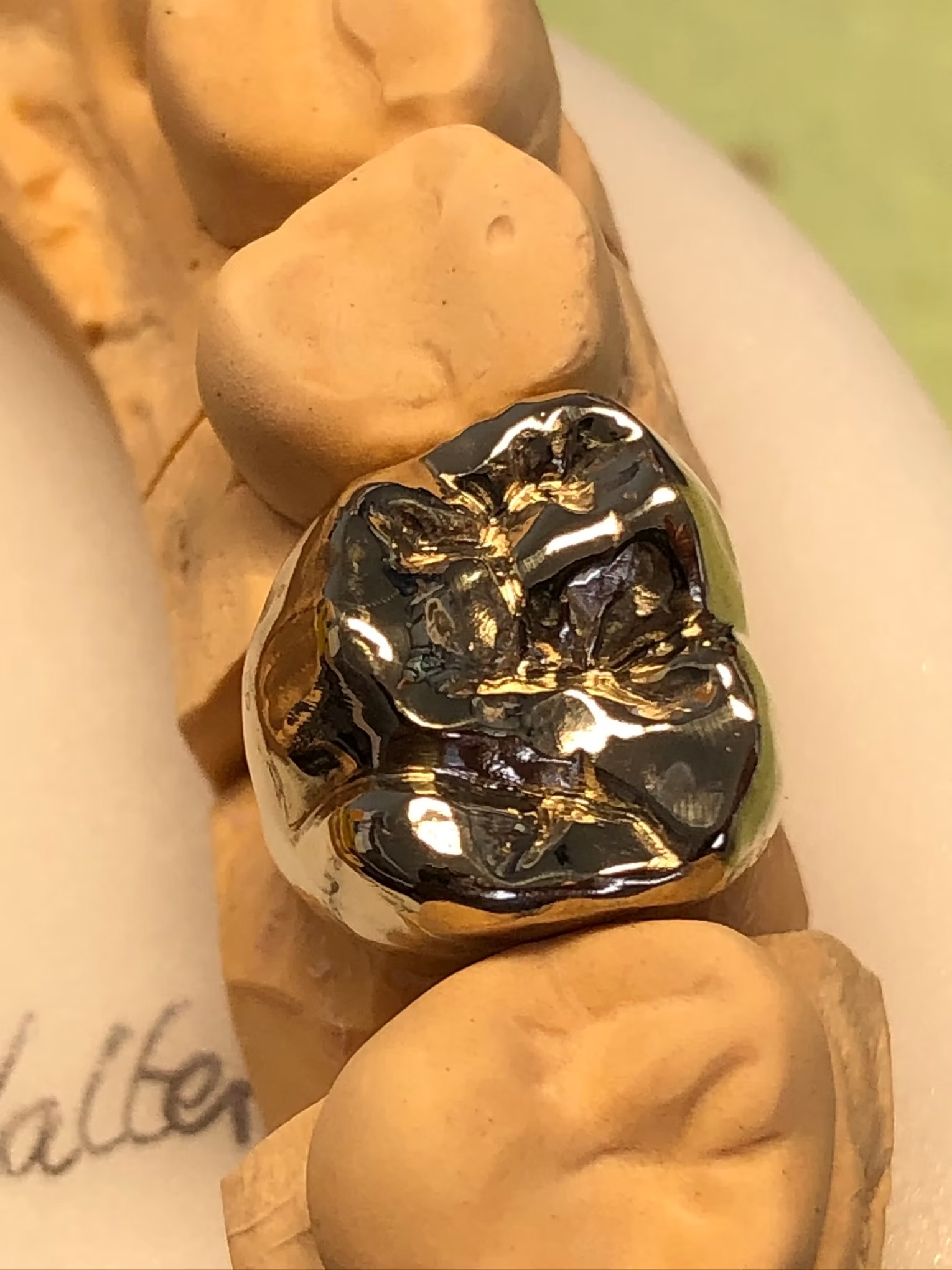 Nahaufnahme eines Zahnmodells mit Zahnkrone aus glänzendem Metall in Goldfarbe
