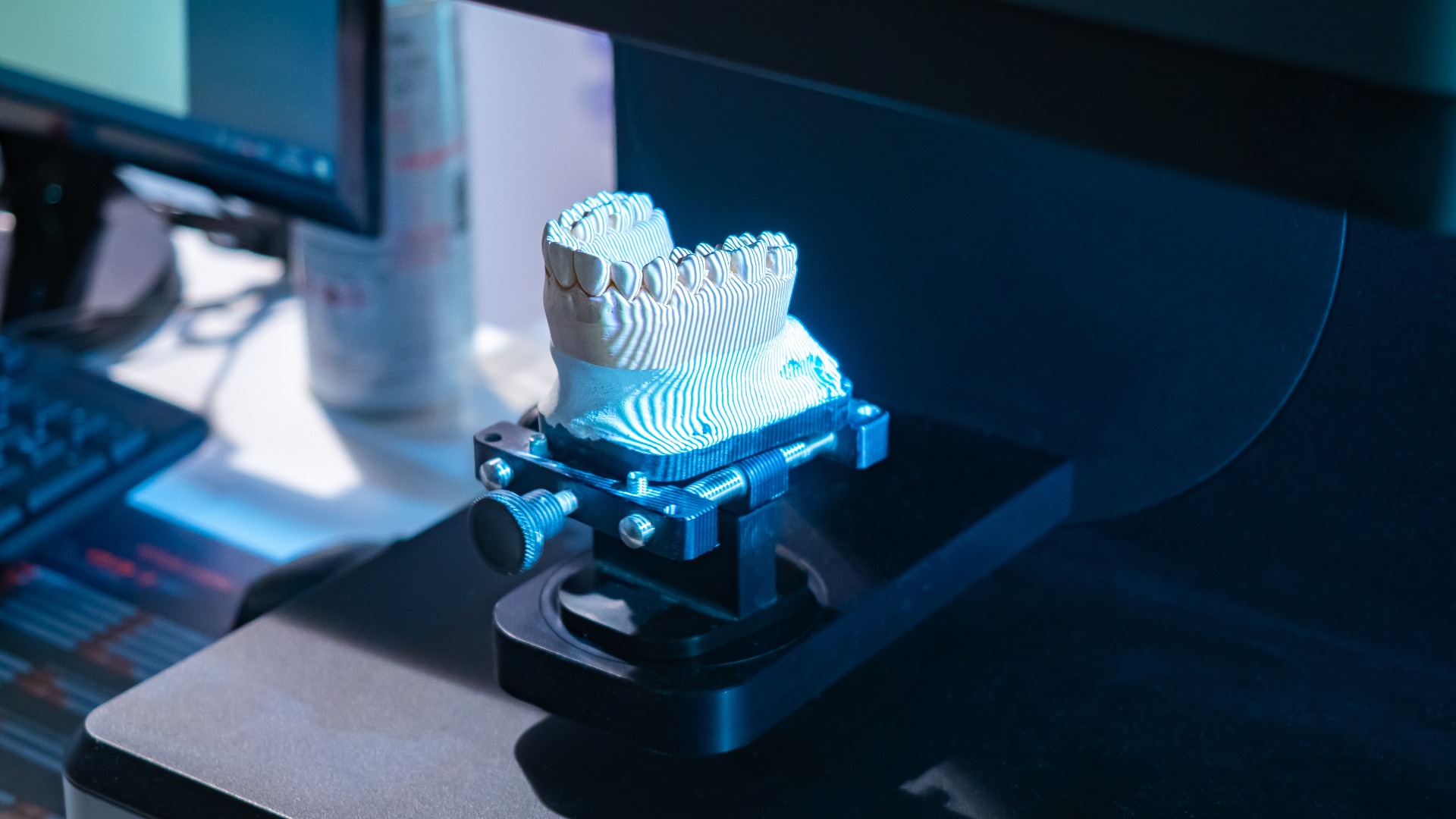 Zahnärztlicher 3D-Scanner. Nahaufnahme eines Zahnscans mit Prothese. Der Scanner wurde entwickelt, um ein dreidimensionales Modell einer Prothese zu erstellen. Zahnarztscanner in einem Dentallabor. Scanner für Zahntechniker.